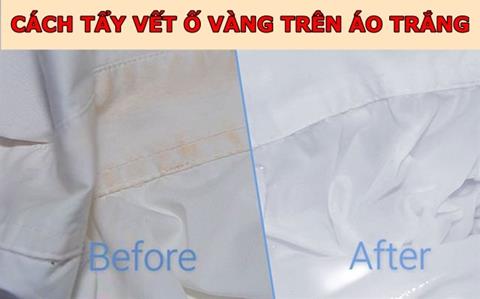 22+ Cách tẩy vết ố vàng trên áo trắng đơn giản, sạch tinh tươm